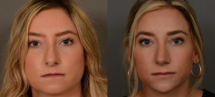 Facial Plastic Surgery Clinics of North America